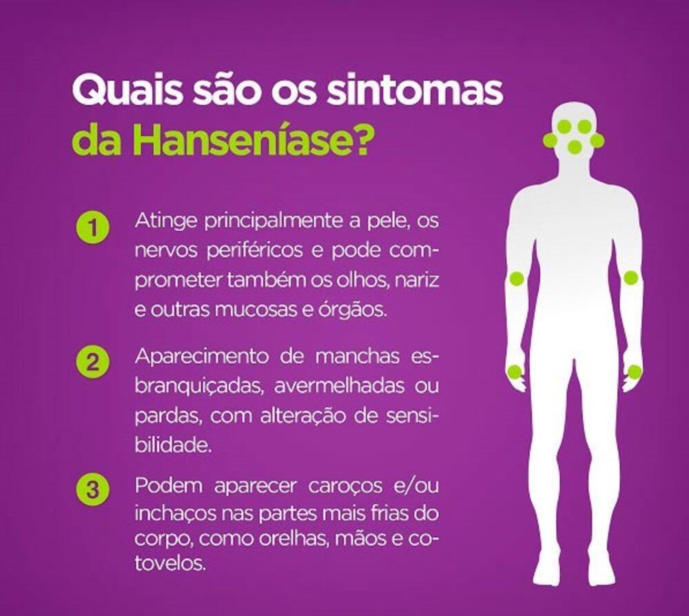 CAMPANHA DE PREVENÇÃO À HANSENÍASE COMEÇA NO DIA 15
